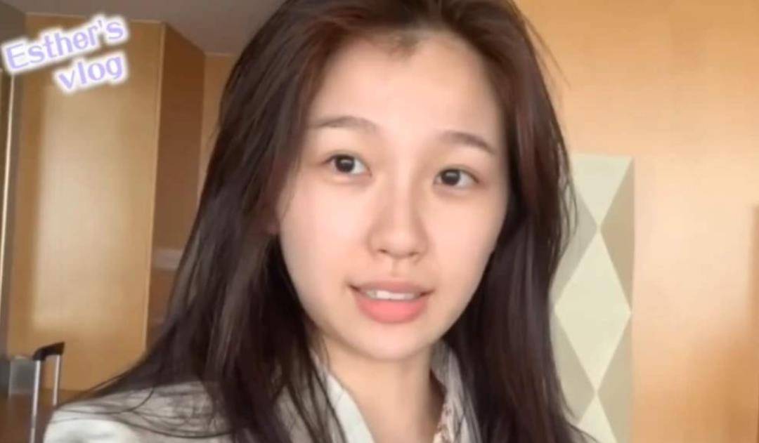 白天虞书欣买35万名表眼都不眨，保养只靠医美？年轻缺少岁月的毒打
