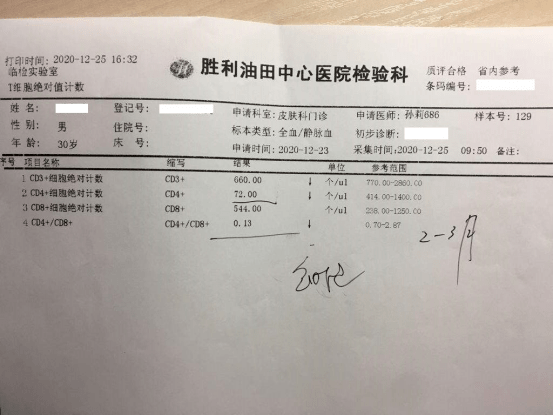 cd4细胞与艾滋病有什么关联多久检测一次