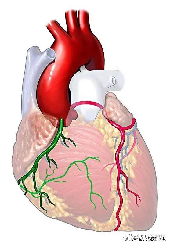 心脏解剖与传导系统_动脉_房室_部分