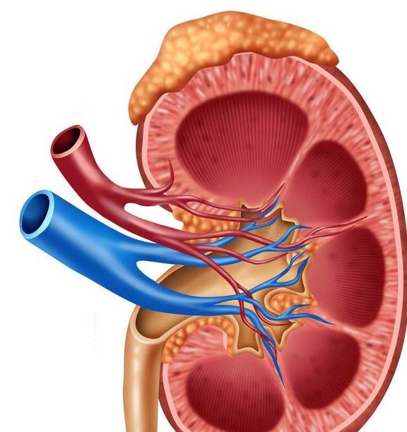 治疗|这种浮肿不同于一般肾病水肿，却异常危险！肾友需小心提防