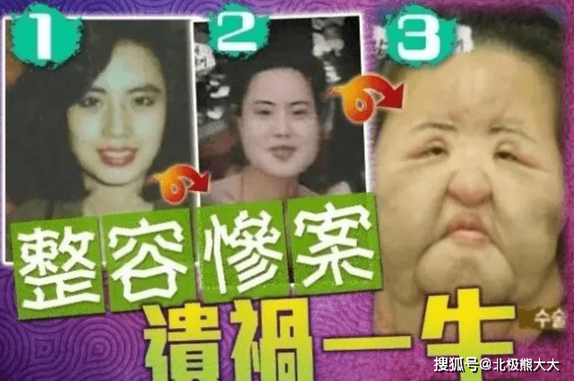 因为痴迷整容15年，把脸整成“电风扇”后遗症明显，韩慧景后悔了吗？