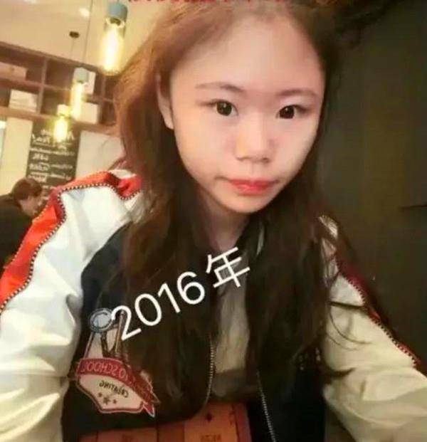 漂亮那个13岁就整容的网红女孩，3年整了60次，如今现状如何？