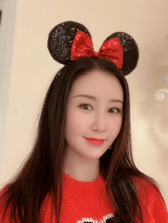 or成功减龄or发面馒头？女星热衷的饱满苹果肌，一不小心成“灾难”