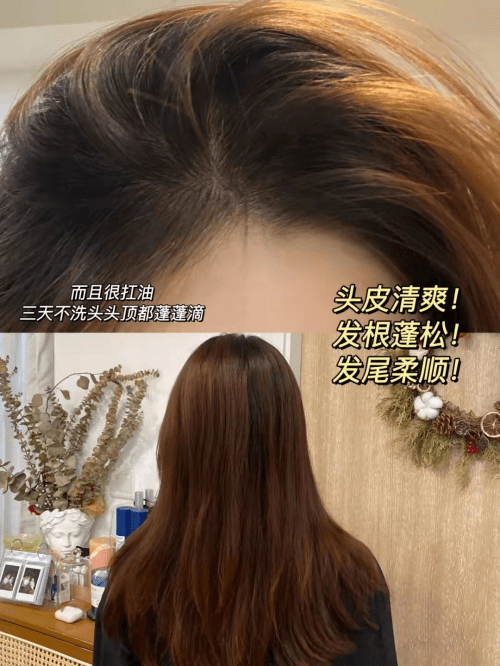 方法染头发把头皮伤了，后面还怎么洗头？！