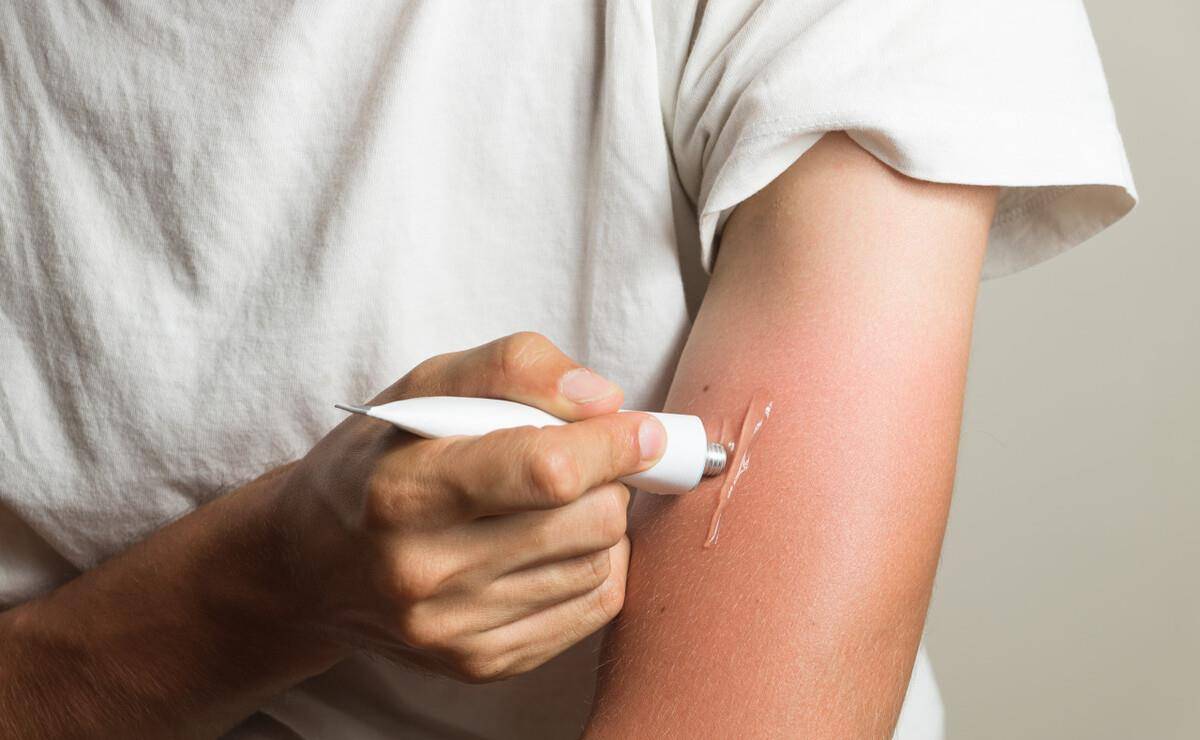 软膏1块钱的红霉素软膏被称为“淡斑专家”?医生告诉您答案