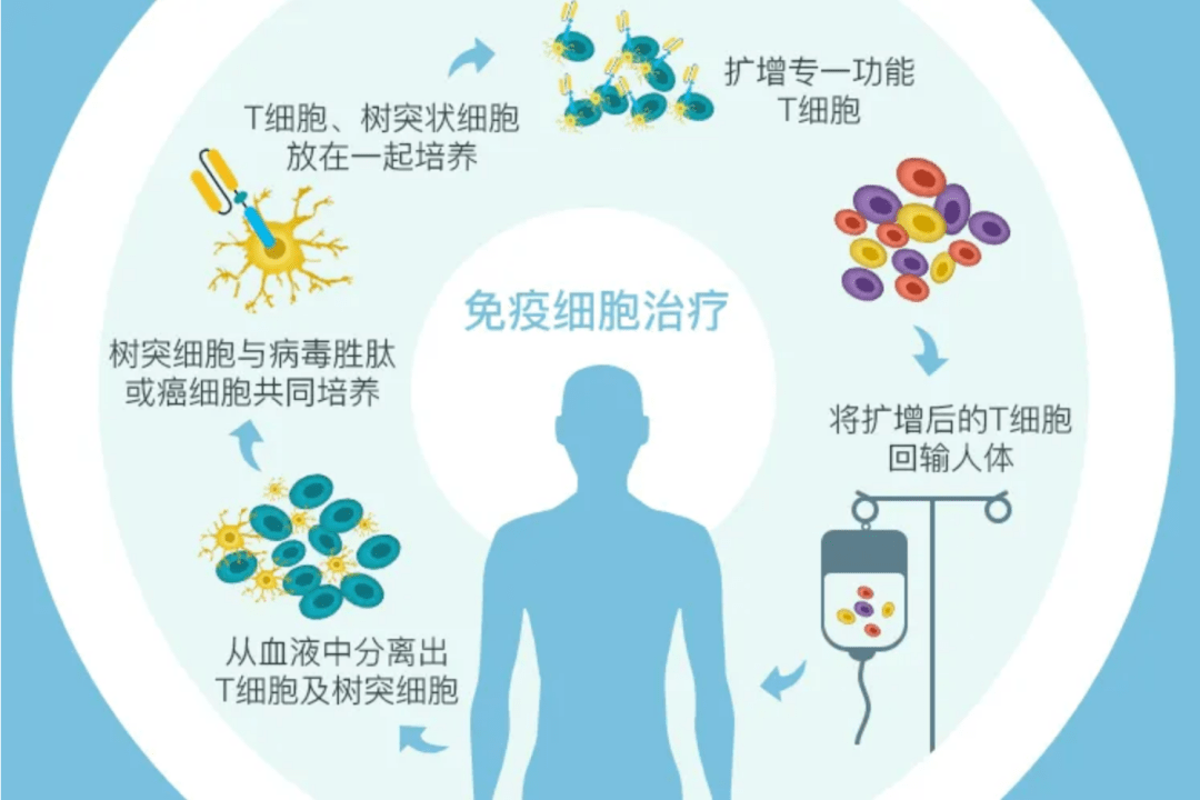 細胞免疫療法是利用患者自身的抗癌細胞進行治療,不會產生毒副作用