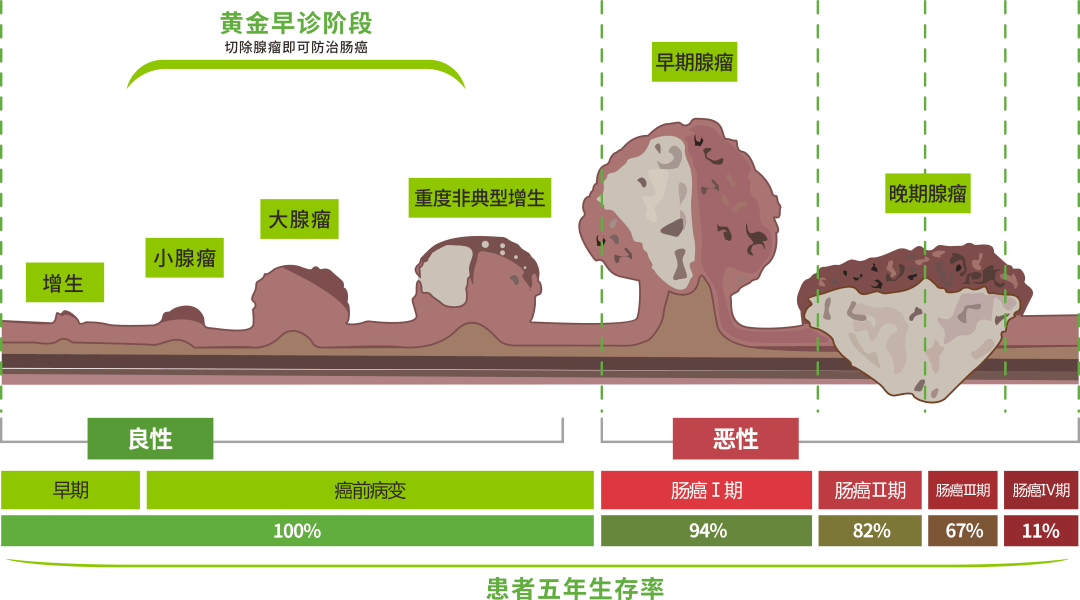 肠癌星专题吴孟达丧礼当天老搭档赵美宝也因肠癌去世