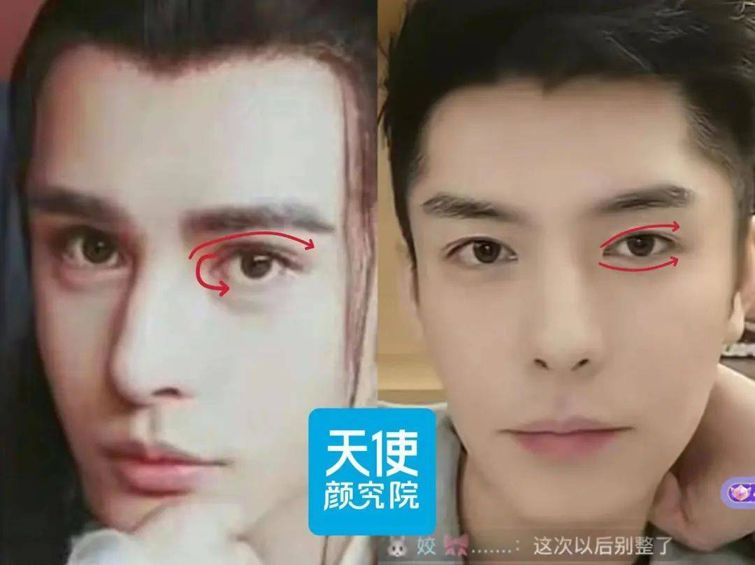 眼睛线条从幼态圆润变得锋利,眉眼距也舒展了,视觉上干净感飙升.