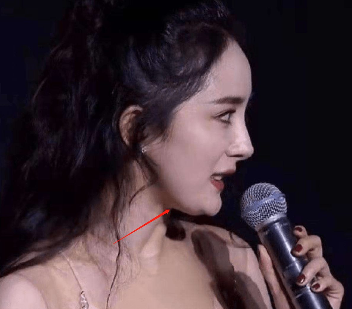脸部明星整牙后遗症：杨幂脸部松弛，王嘉尔颧骨外扩，宋祖儿法令纹深！！