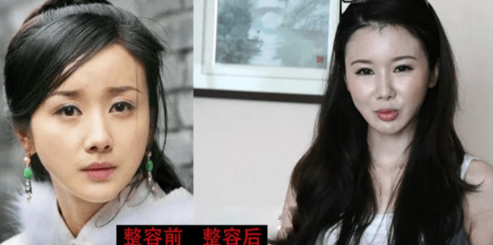 下巴“换脸”后好运连连的8大女星：杨颖逆袭成顶流，陈小纭咸鱼翻身