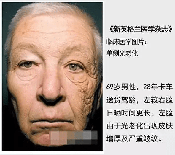 人体加速女人衰老快的七个主要原因，女人防止衰老最有效的方法？