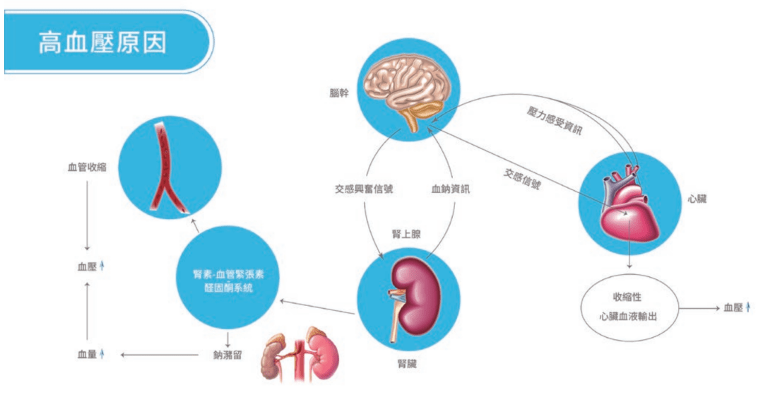 高血压“药不能停”或成历史_患者_治疗_手术