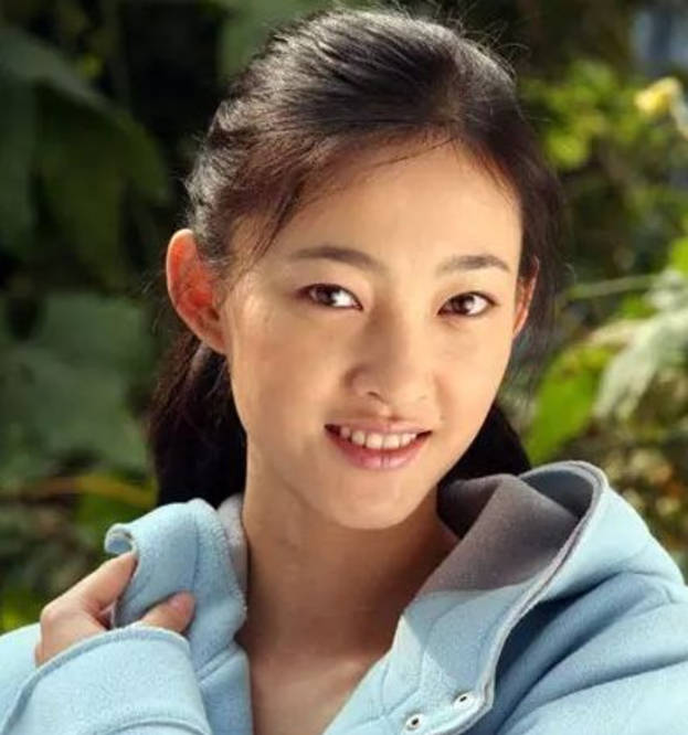 单眼皮女星割双眼皮如跨分水岭，没整好变“悲伤蛙”，成功则变气质美女？