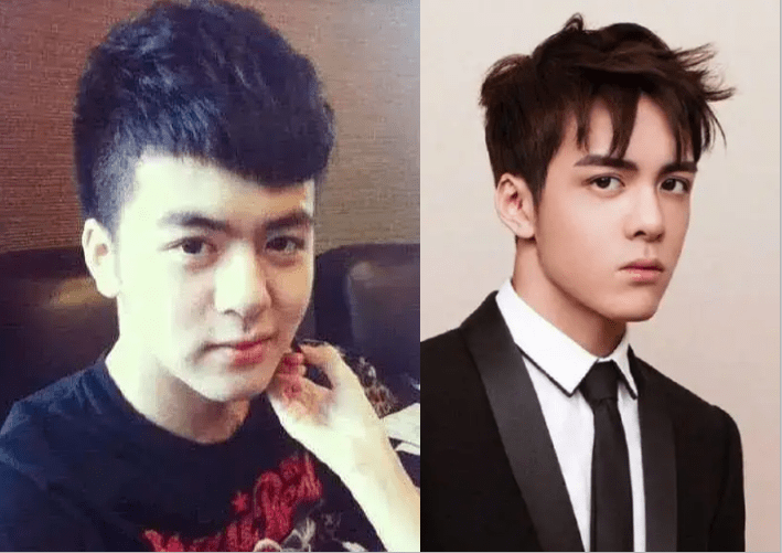 原创下巴尖成锥子脸蛋僵硬成石这些流量男星的脸到底咋了