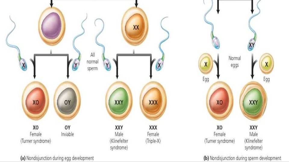 女性_染色体_塞门亚