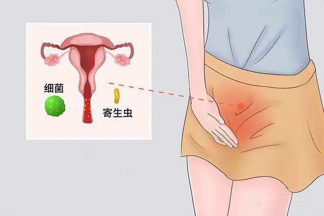 女性尿道寄生虫症状图片