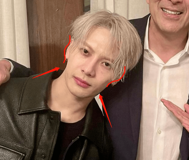 王嘉尔嘴又凸了!受整牙后遗症影响的明星,有人恢复了有人更严重