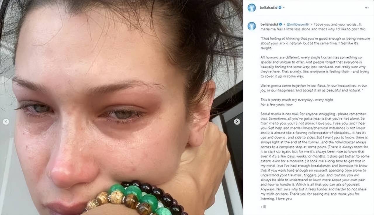 bella后悔整成翘鼻,风光如她也有崩溃ab面