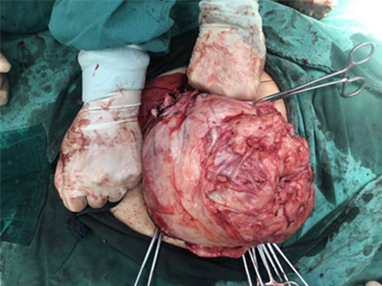 妇科专家张玉荣:患者信赖的女医生,以精湛医术,呵护女