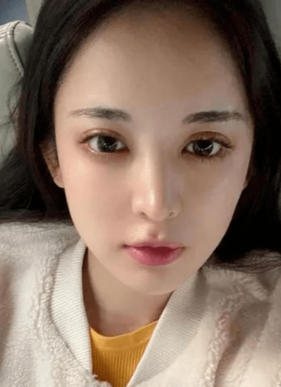 原创鼻子撑起整张脸这10位隆鼻的明星有人整成阿凡达有人逆袭