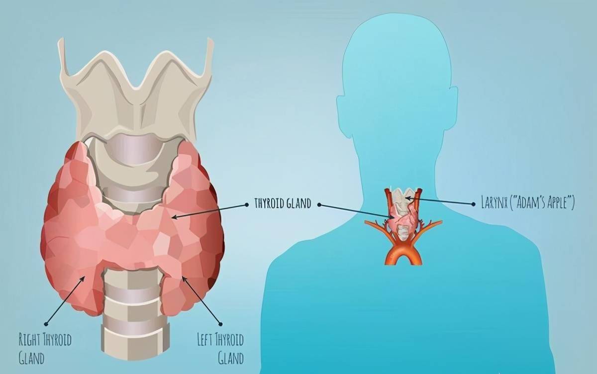 脖子變粗多發性的甲狀腺結節還有哪些表現如何預防