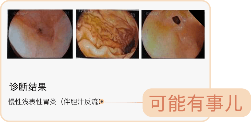 胃镜病理报告报告单图片