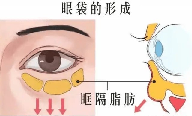 了解原因才好对症解决_脂肪_皮肤_韧带