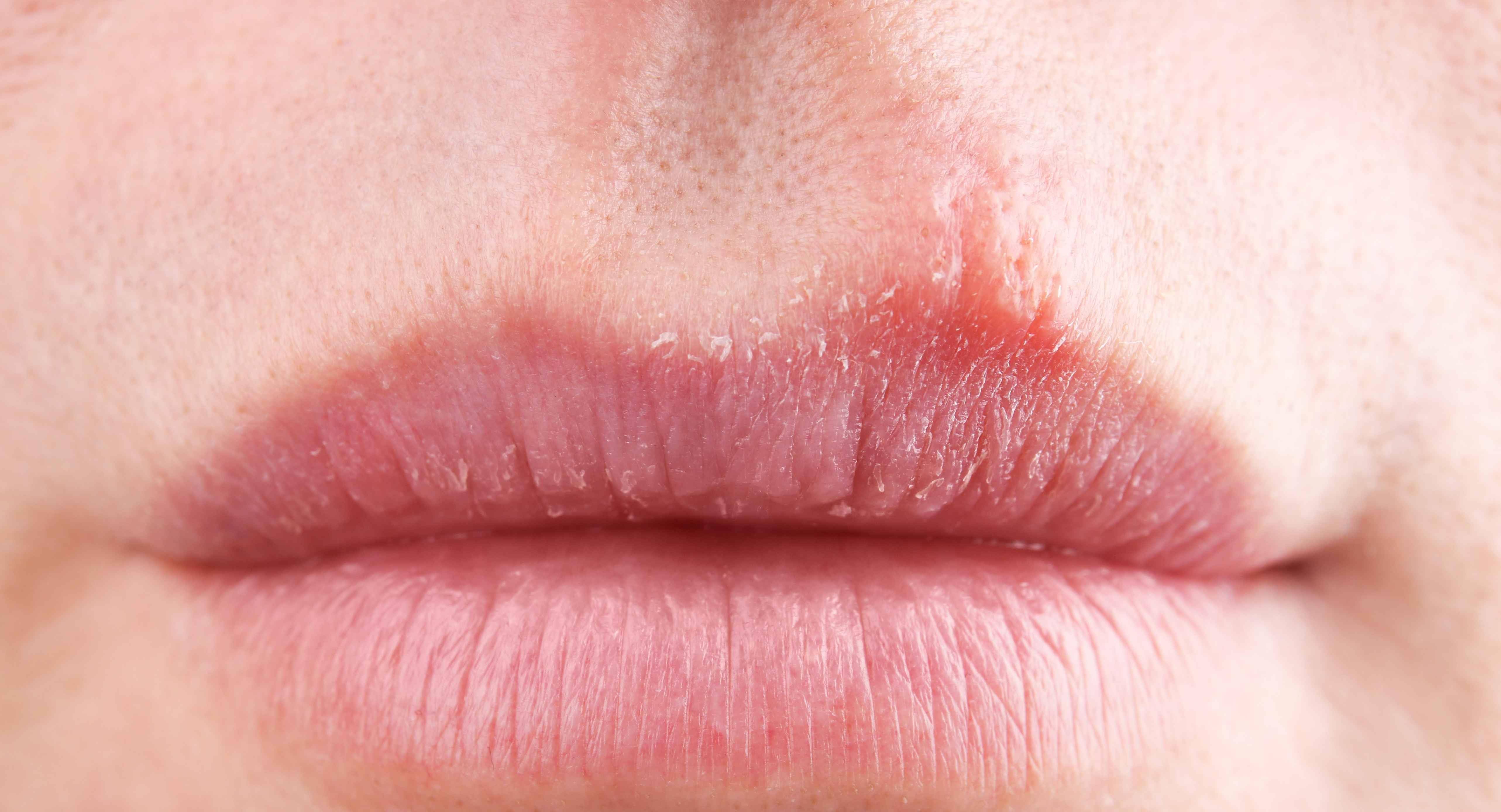 原创嘴唇总是干燥的原因找到了除了缺水第四个你应该没想到