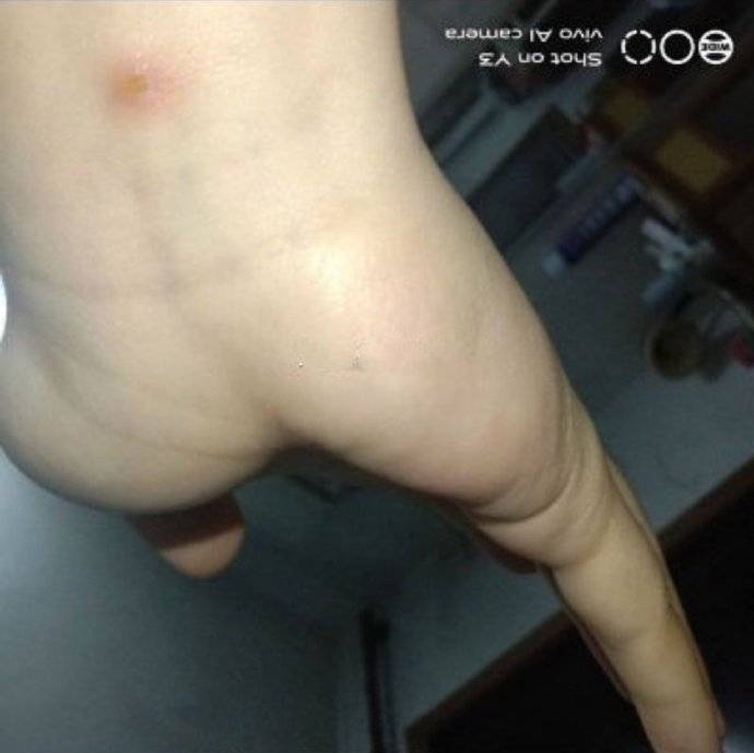 原创
搞笑GIF段子:女神发来照片说她受伤了,我大受震撼!
一、搞笑动态图,搞笑趣图!二、搞笑段子,爆笑笑话!