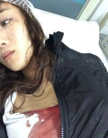 原创她曾是古装第一美人却被著名女星的狗咬毁容整容5次仍翻不了身