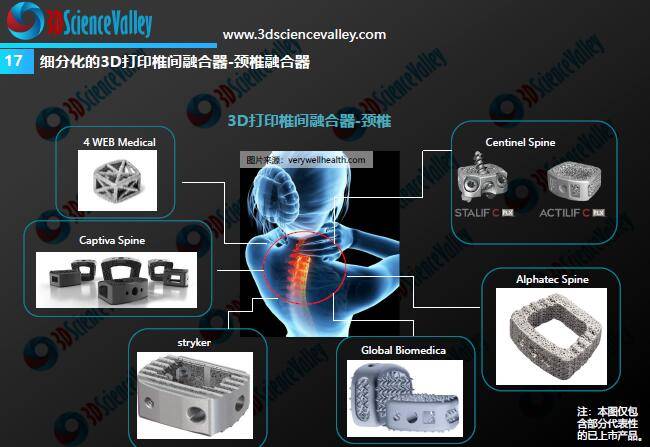 3d打印增材製造新材料醫療器械及相關監管科學研究進展概況