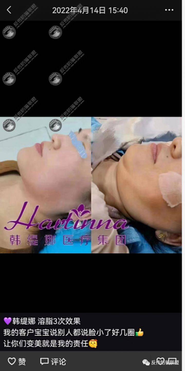 不打针不手术 黑科技瘦身抗衰的“韩缇娜”有点“黑”(图6)