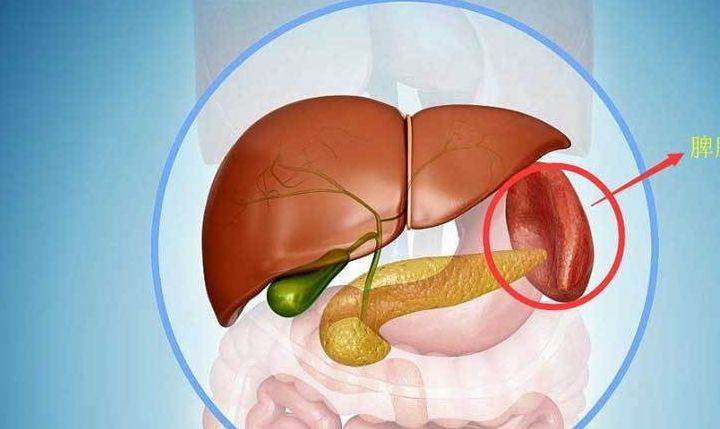 脾大是肝硬化吗认清脾大和肝硬化的关系了解其中的危害