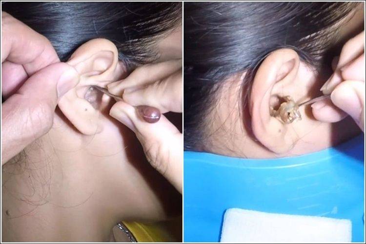 身上不是越干净越好,这4个部位,适当"脏点"更健康_阴道_耳朵_耳屎