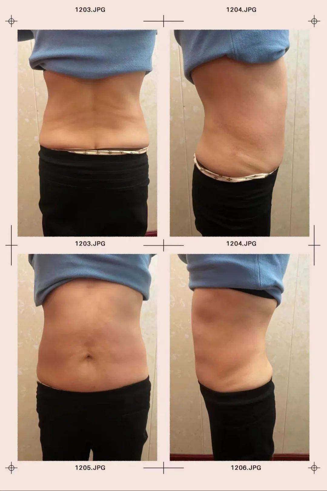 而刘小姐就是在这样的环境下,长胖了十几斤!