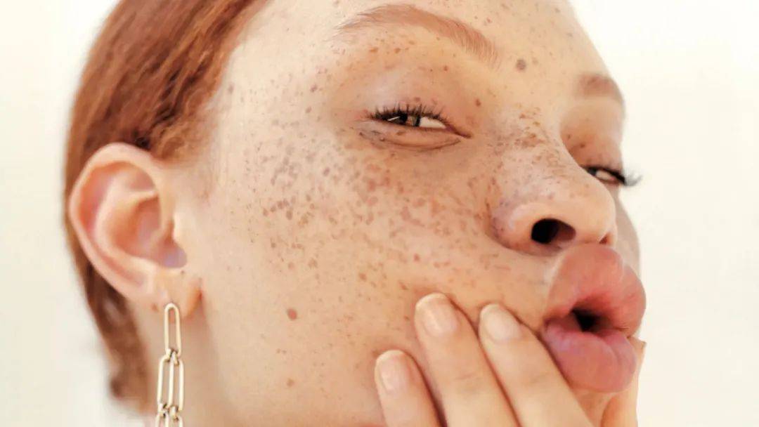 国际资讯 | 唇部皱纹的最佳治疗方法_皮肤_细纹_图片