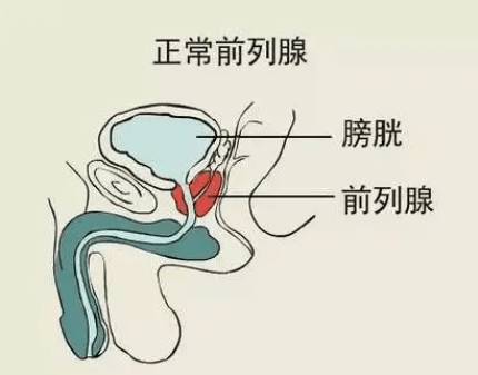 可以看到上面的前列腺示意图