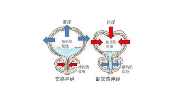 那么尿失禁产生的原因来讲的话,无非就是.