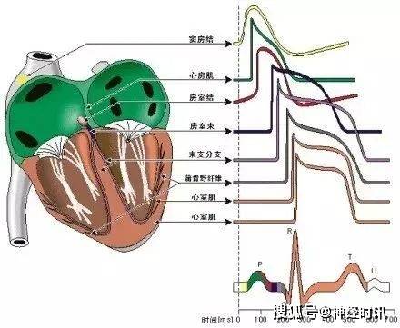 心血管疾病圖譜合集 —— 經典!_心電圖_鑑別_心臟