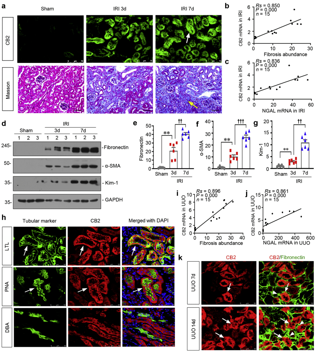 cb2通过与βcatenin通路相互作用促进肾脏纤维化的发生发展