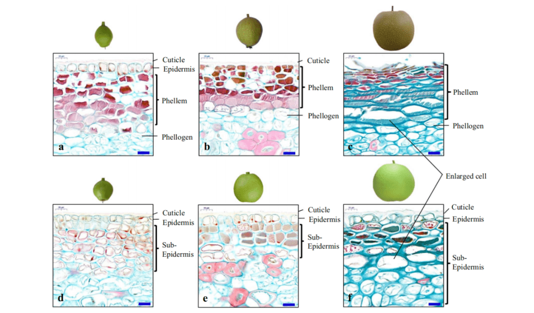 梨果实的石细胞图解图片