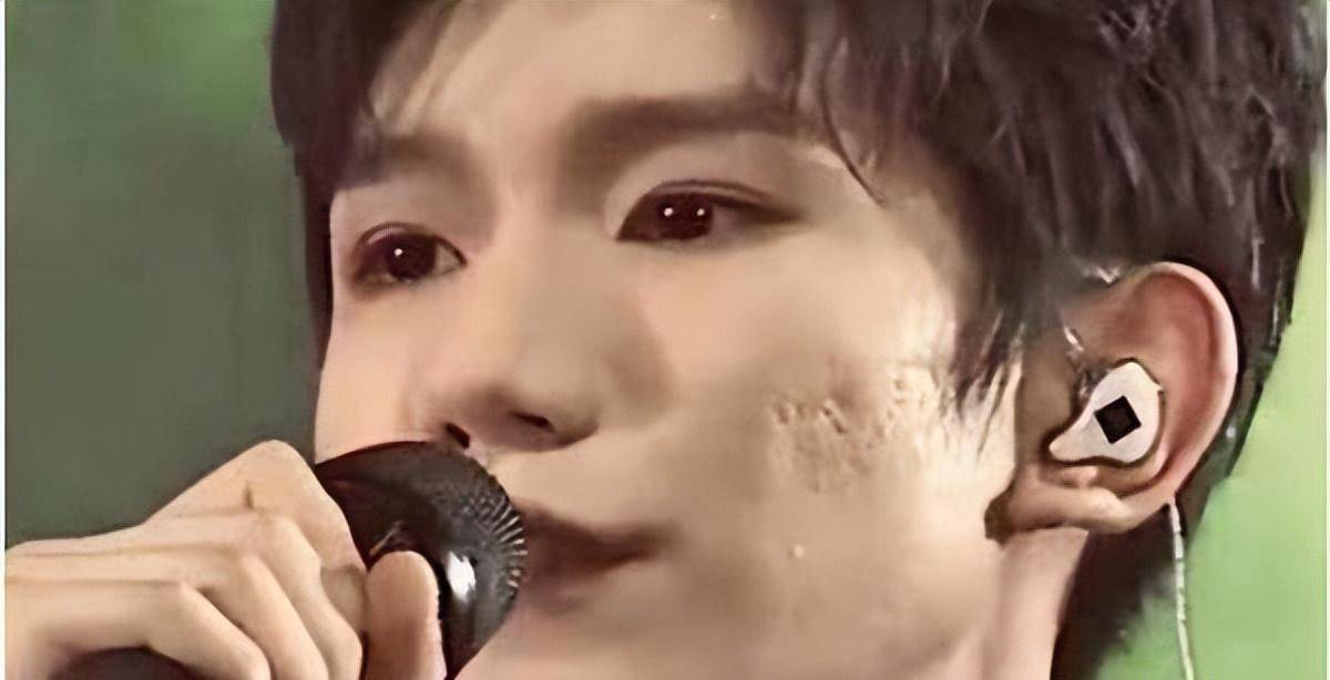 原创抽烟爆痘王源为何成了三小只中发展最差的一位