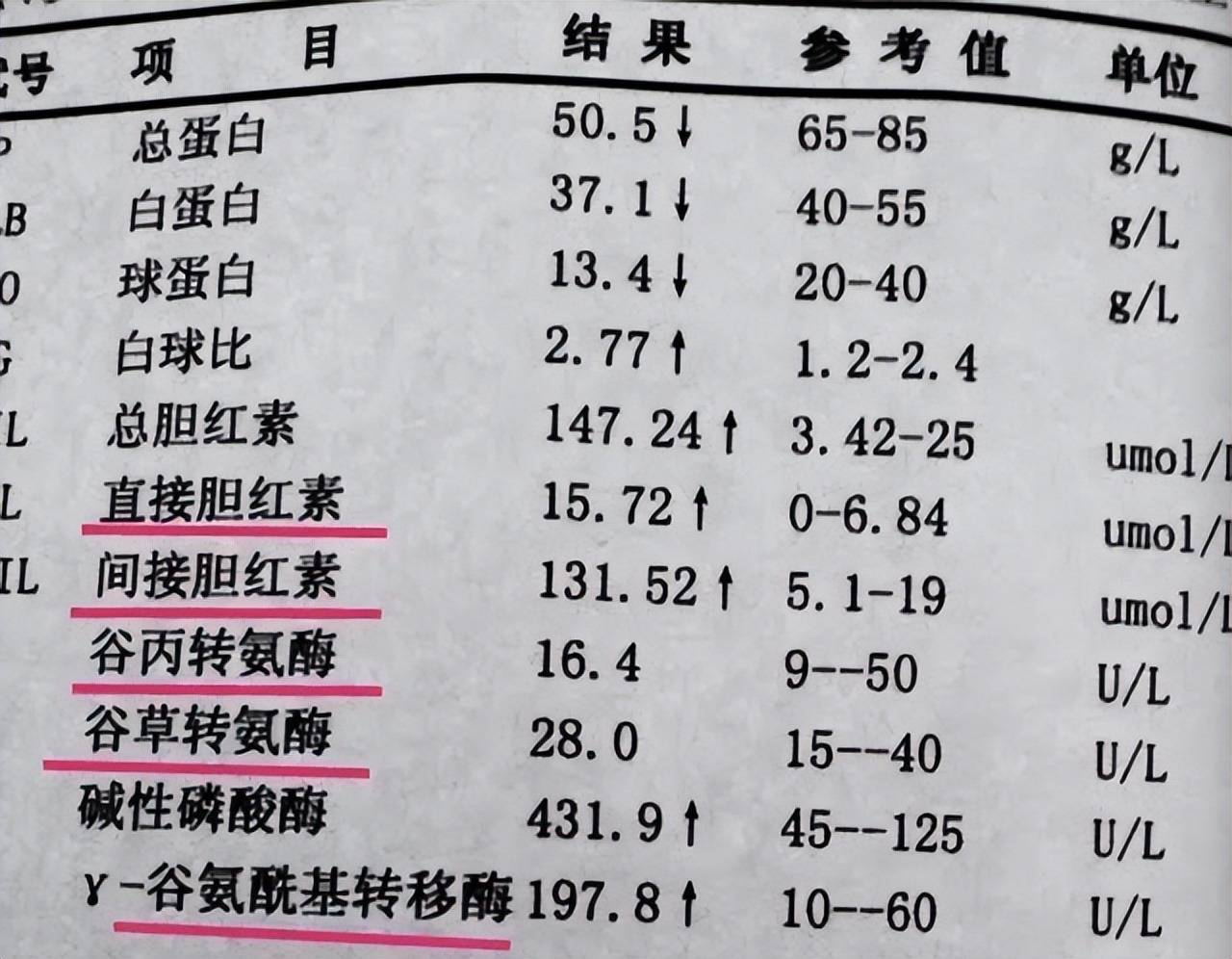 比如當我們拿到一張肝功能檢查單時,單子上面的頭兩項就是谷丙轉氨酶