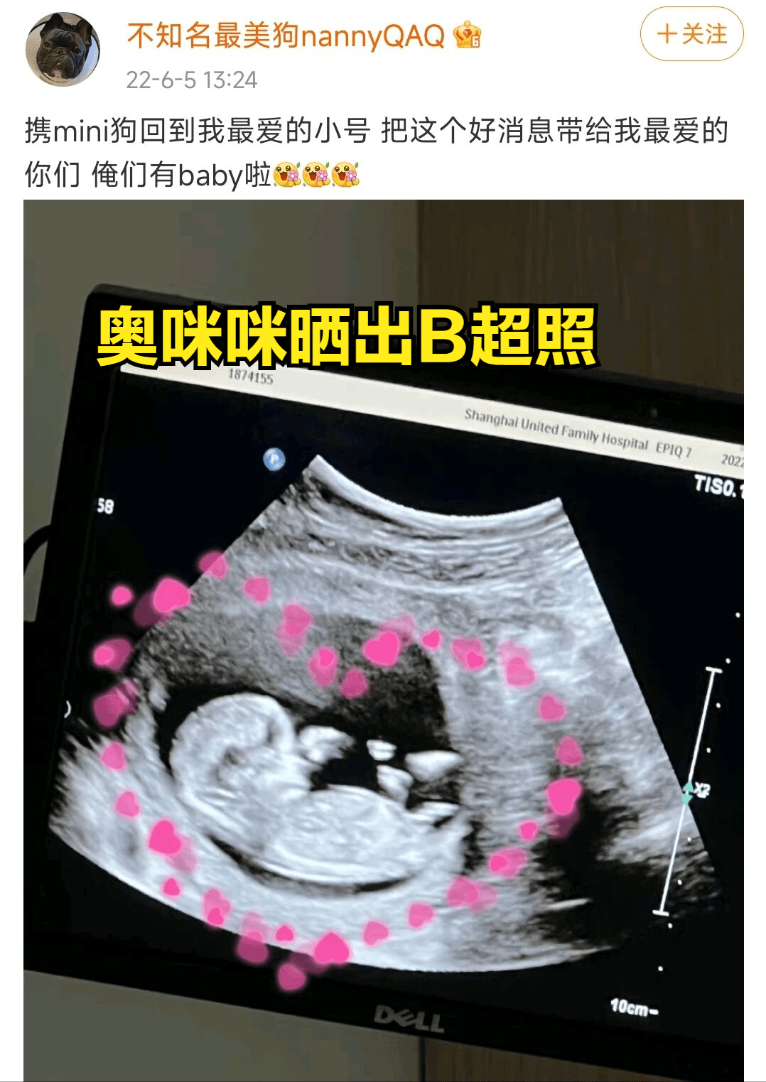 男女啪啪b超图片