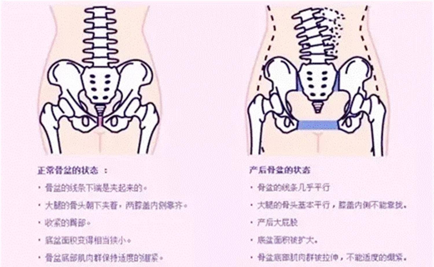 女人骨盆大图片