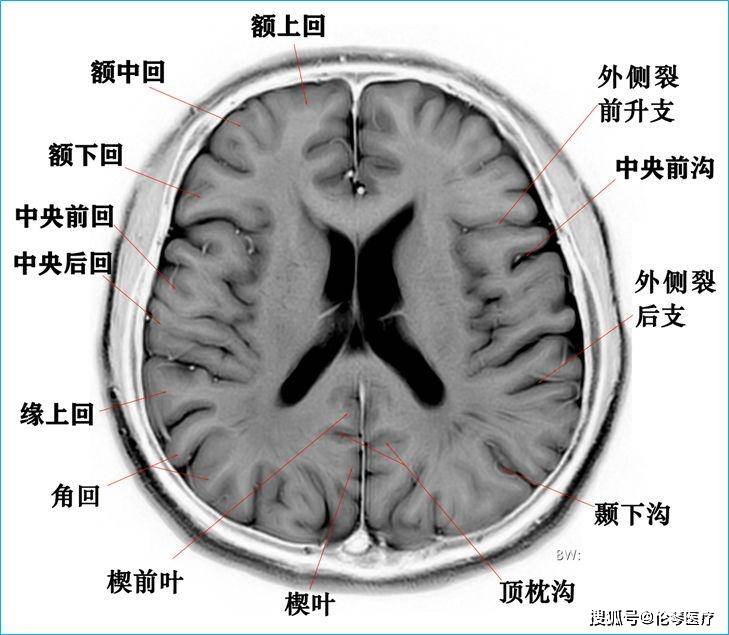 头颅解剖图 分层图片