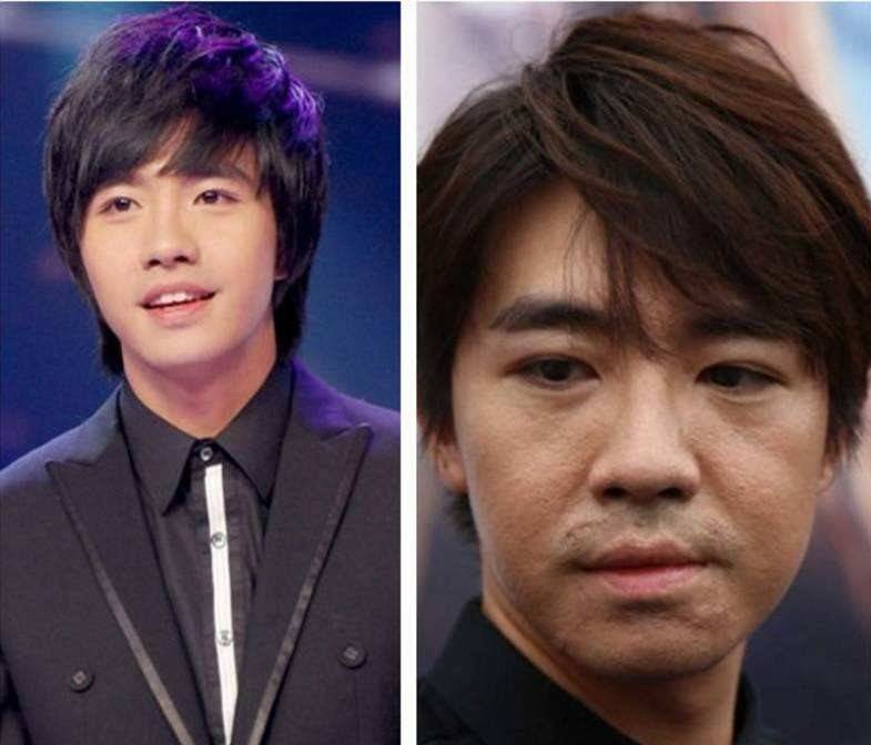 他曾是当红小生,毁容后去韩国整容,如今整完成这样?