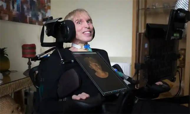 真的不是科幻小说全球首位赛博人的传奇一生