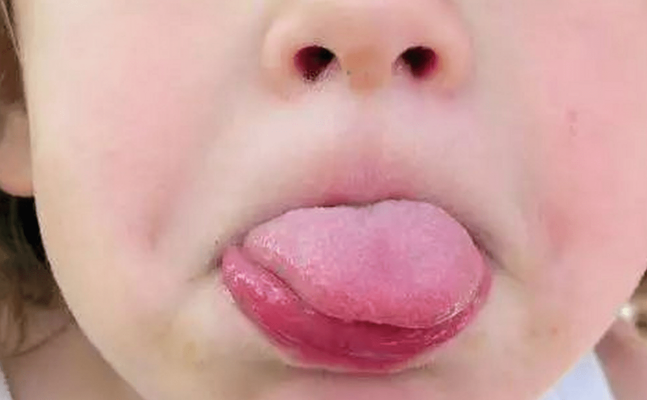 宝宝六个月长的乳牙,如何做好科学护理工作,关系到后期换牙问题