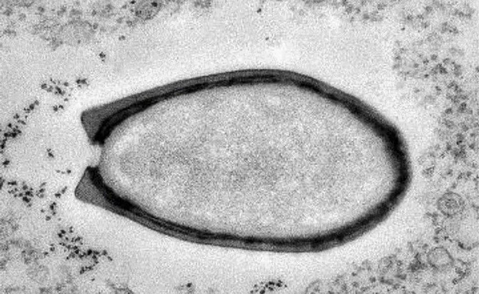 在西伯利亚的永冻土冰芯中,科学家们发现了一种称为阔口罐病毒的巨型
